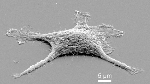An electron microscope image of a zombie cell.