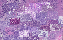 Argonne researching are using Singularity as part of their work with the CANDLE project, which aims to predict cancer type and drug response using histopathology images from the National Cancer Institute’s Patient-Derived Models Repository. (Image credit: Rick Stevens, Argonne National Laboratory)