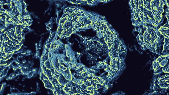 Image of a microsized pore and tunnel in an electrode