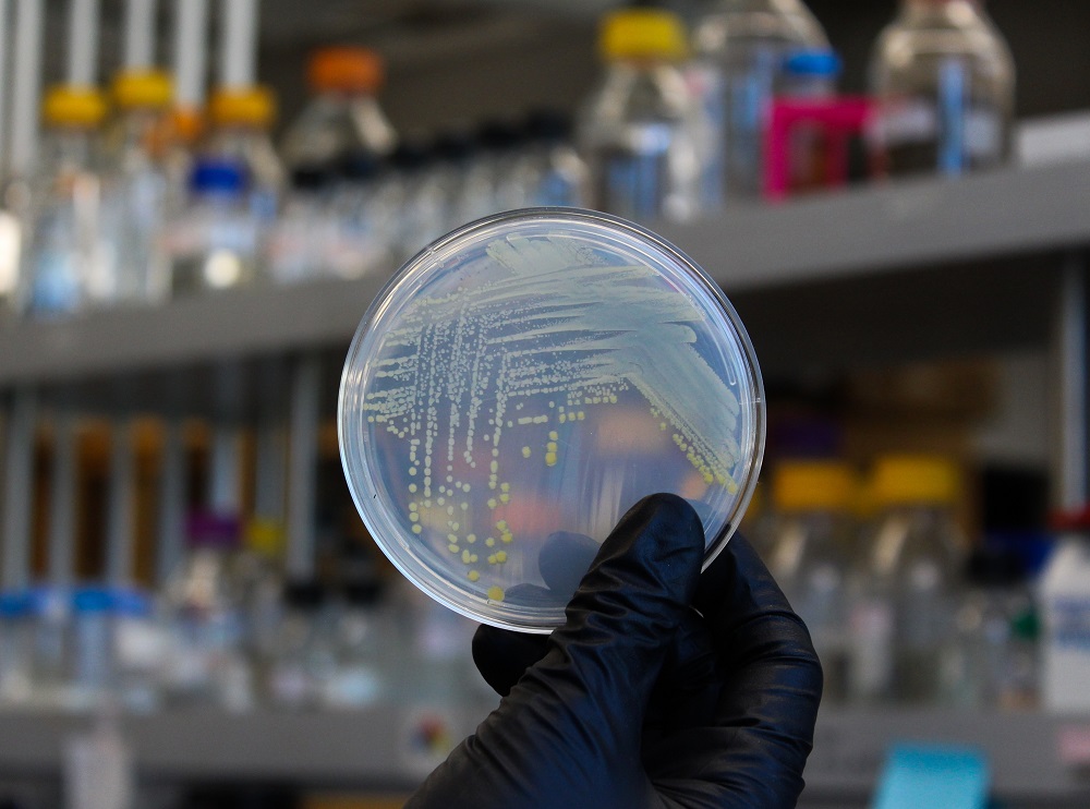 A petri plate with bacterial colonies.