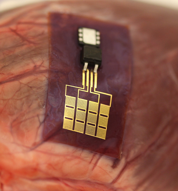 Arrays of nanoribbons of lead zirconate titanate (gold, bottom) on a sheet of flexible polymer (brown) produce current pulses during each heartbeat.